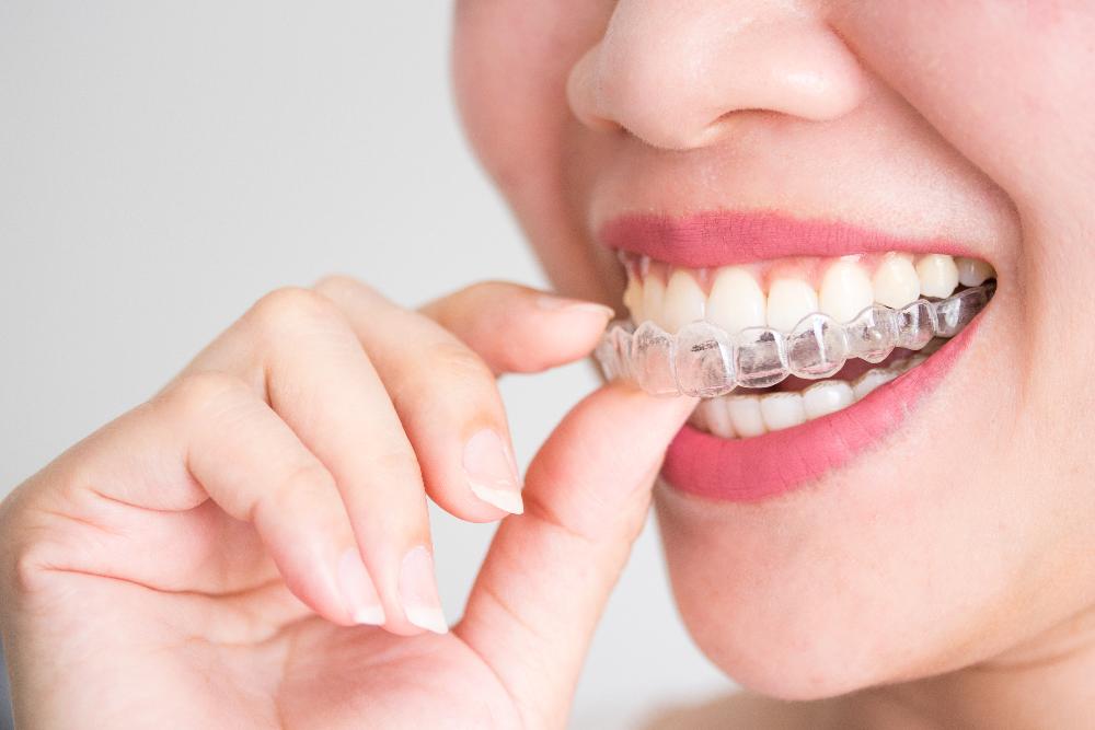 patient holding clear plastic aligner | clear aligners beaverton