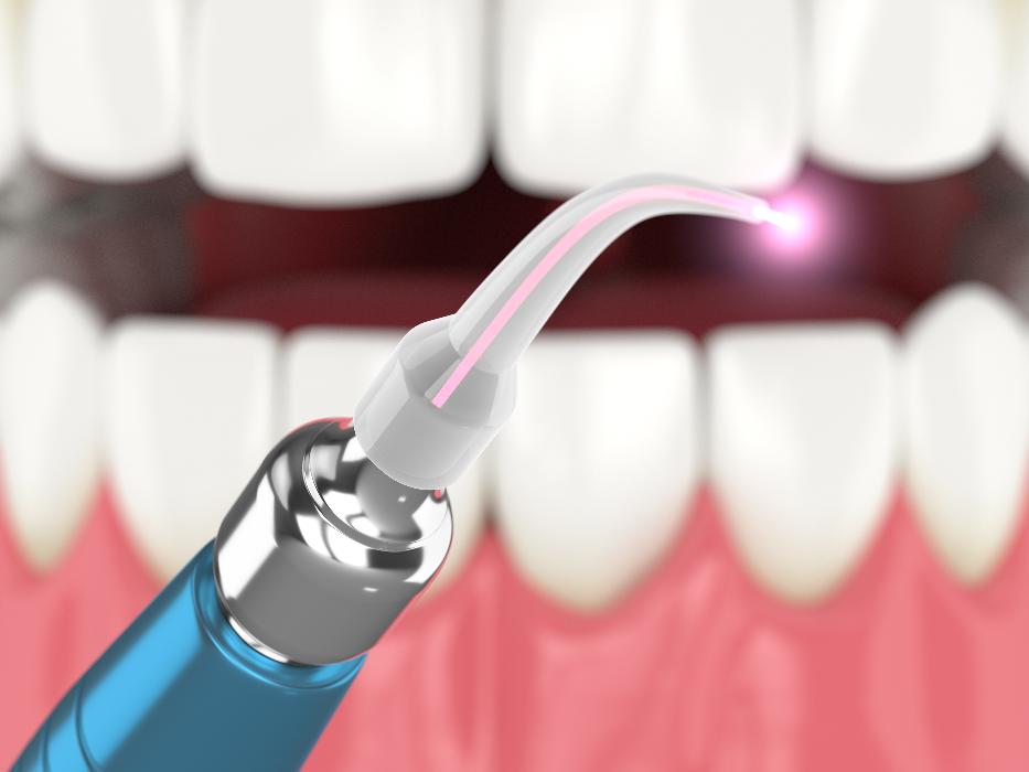 close up of laser dentistry tool | beaverton dentist