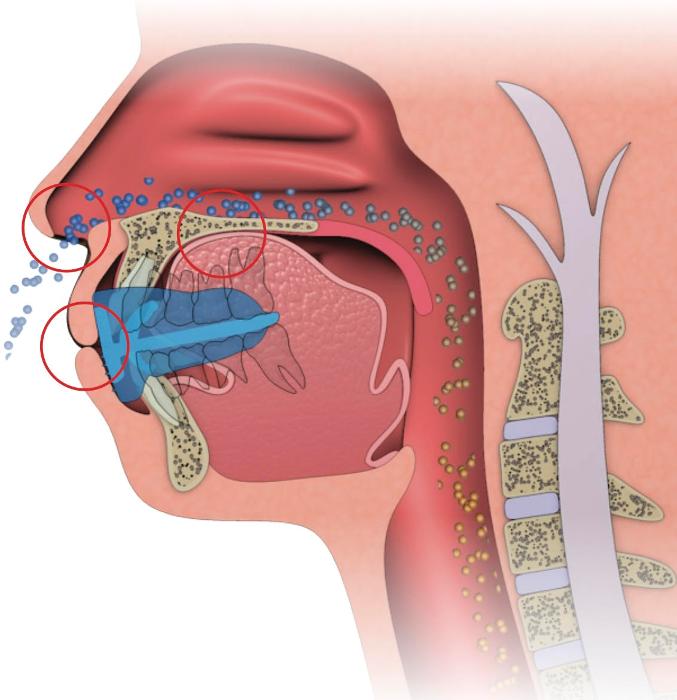 interior image of persons throat | dentist beaverton or