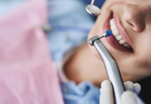 women getting dental cleaning in beaverton or