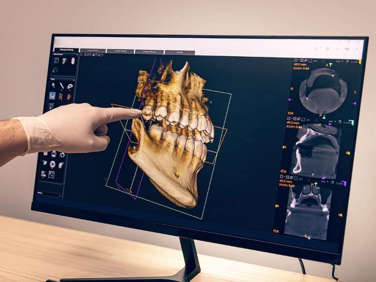 3D Cone Beam Technology at Beaverton Dental Office