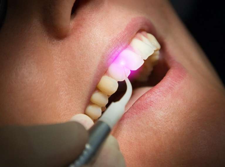 laser dentistry technology in beaverton or